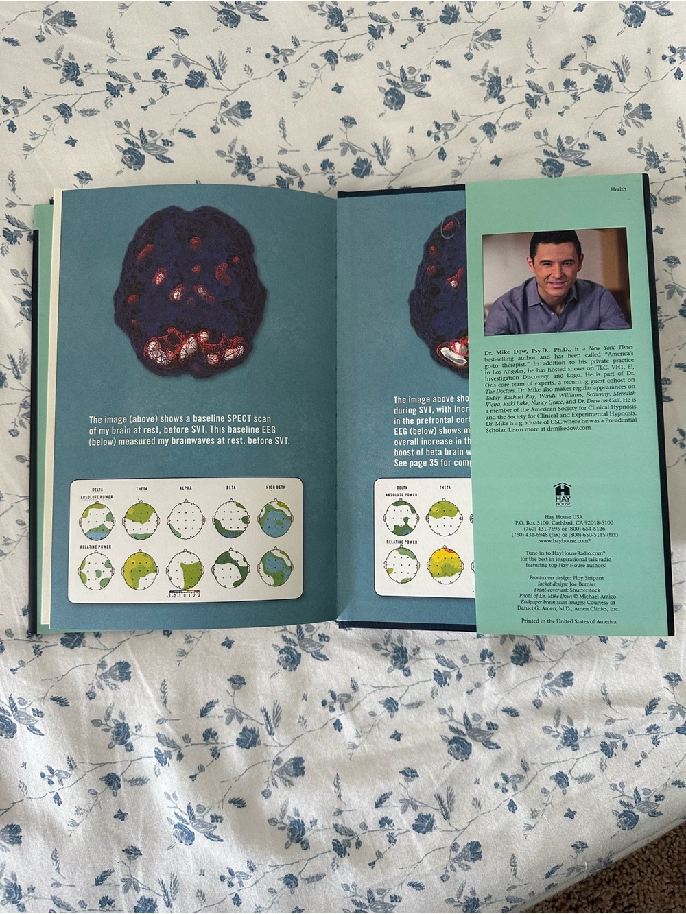 Your Subconscious Brain Can Change Your Life by Dr. Mike Dow (Hardcover) - Picture 4 of 5